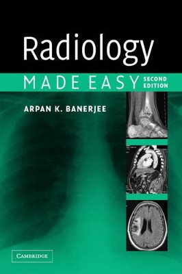 Radiology Made Easy book