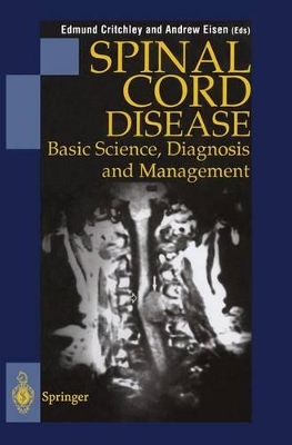 Spinal Cord Disease book
