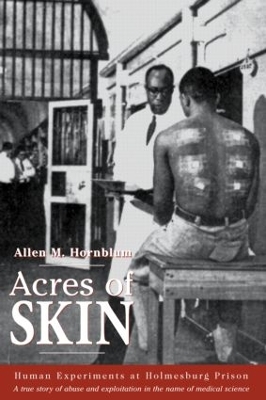 Acres of Skin book