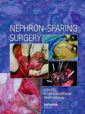 Nephron-Sparing Surgery by Krishna Sasidharan