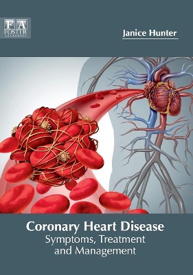 Coronary Heart Disease: Symptoms, Treatment and Management book