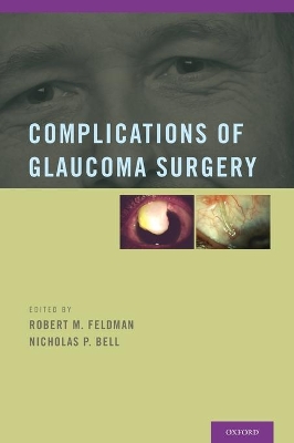 Complications of Glaucoma Surgery book
