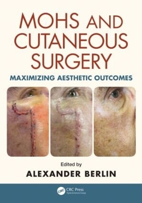 Mohs and Cutaneous Surgery book