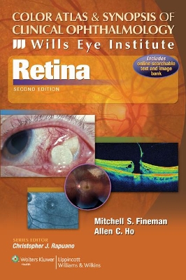 Color Atlas and Synopsis of Clinical Ophthalmology -- Wills Eye Institute -- Retina book