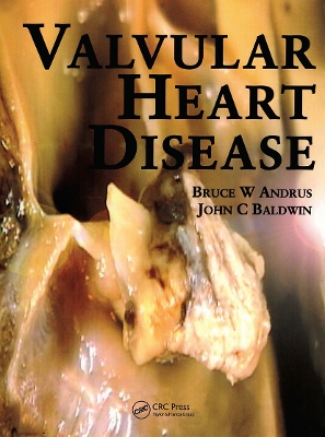 Valvular Heart Disease book