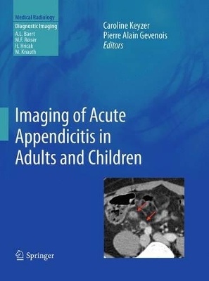 Imaging of Acute Appendicitis in Adults and Children book
