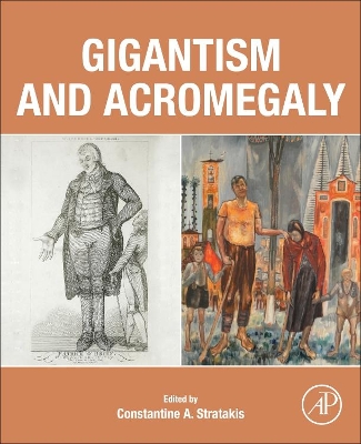 Gigantism and Acromegaly book