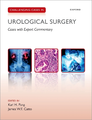 Challenging Cases in Urological Surgery book