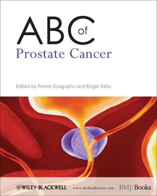 ABC of Prostate Cancer by Prokar Dasgupta