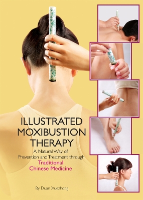 The Illustrated Moxibustion Therapy: A Natural Way of Prevention and Treatment through Traditional Chinese Medicine book