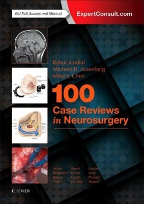 100 Case Reviews in Neurosurgery book