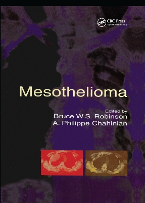 Mesothelioma by Bruce W S Robinson