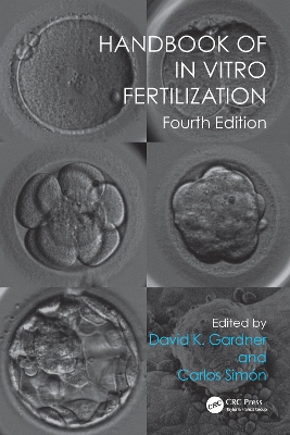 Handbook of In Vitro Fertilization, Fourth Edition book