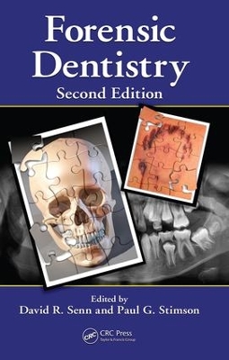 Forensic Dentistry by David R. Senn
