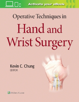 Operative Techniques in Hand and Wrist Surgery book