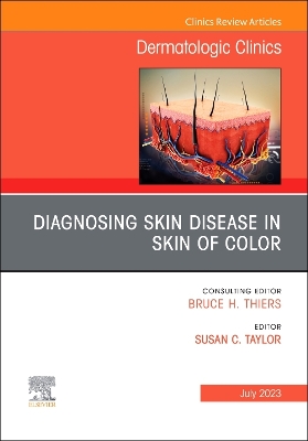 Diagnosing Skin Disease in Skin of Color, An Issue of Dermatologic Clinics: Volume 41-3 book