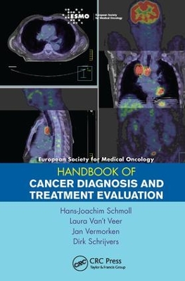 Esmo Handbook of Cancer Diagnosis and Treatment Evaluation by Hans-Joachim Schmoll