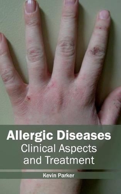 Allergic Diseases by Kevin Parker