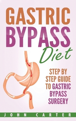 Gastric Bypass Diet: Step By Step Guide to Gastric Bypass Surgery book