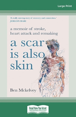 A Scar is Also Skin: A memoir of stroke, heart attack and remaking by Ben Mckelvey