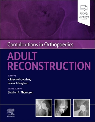 Complications in Orthopaedics: Adult Reconstruction book