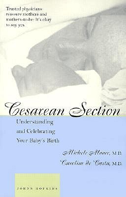 Cesarean Section book