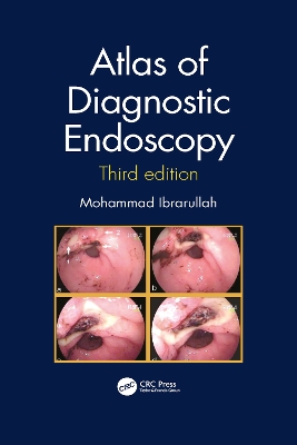 Atlas of Diagnostic Endoscopy, 3E book