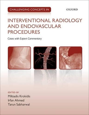 Challenging Concepts in Interventional Radiology book