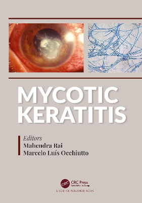 Mycotic Keratitis by Mahendra Rai