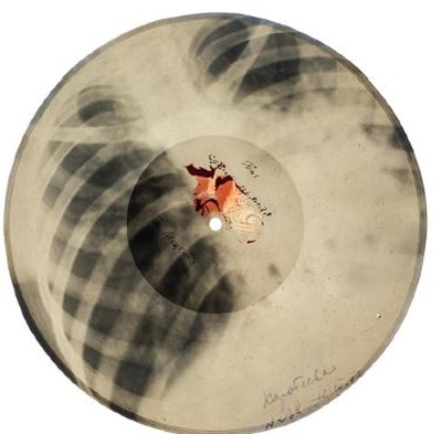 X Ray Audio book