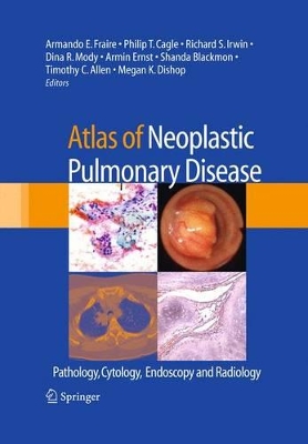 Atlas of Neoplastic Pulmonary Disease by Armando E. Fraire