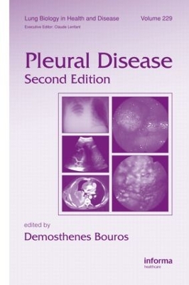 Pleural Disease book