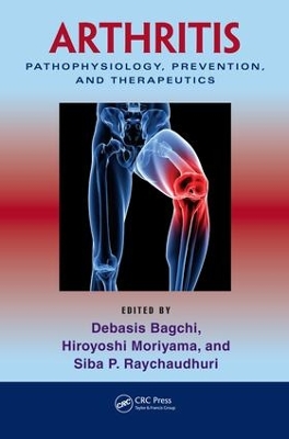 Arthritis: Pathophysiology, Prevention, and Therapeutics by Debasis Bagchi