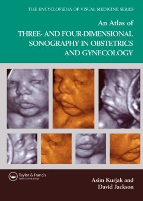 Atlas of Three- and Four-Dimensional Sonography in Obstetrics and Gynecology book