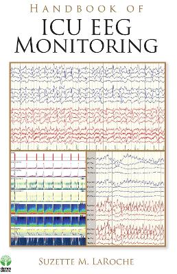 Handbook of ICU EEG Monitoring book