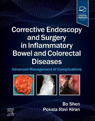 Corrective Endoscopy and Surgery in Inflammatory Bowel and Colorectal Diseases: Advanced Management of Complications book