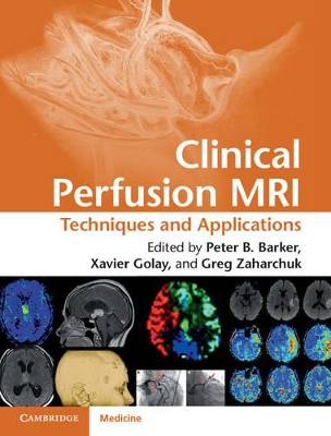 Clinical Perfusion MRI book