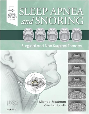 Sleep Apnea and Snoring: Surgical and Non-Surgical Therapy book