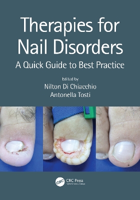 Therapies for Nail Disorders: A Quick Guide to Best Practice by Antonella Tosti