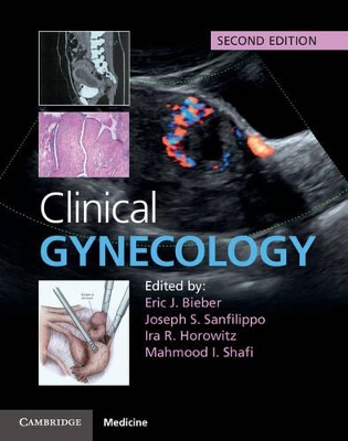 Clinical Gynecology book