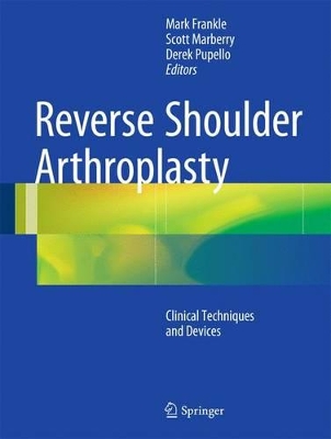 Reverse Shoulder Arthroplasty by Mark Frankle