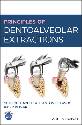 Principles of Dentoalveolar Extractions book