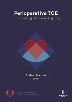 Perioperative TOE: Transoesophageal Echocardiography book