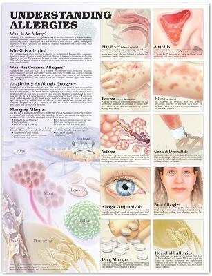 Understanding Allergies Anatomical Chart book