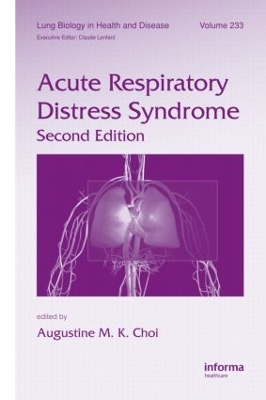 Acute Respiratory Distress Syndrome book