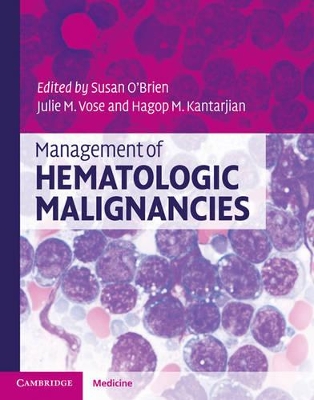 Management of Hematologic Malignancies book