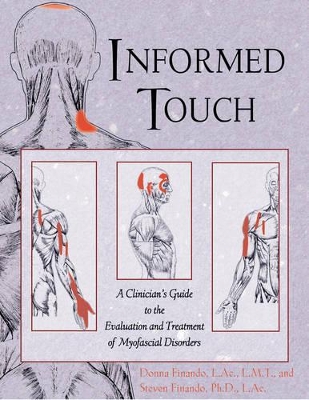 Informed Touch: New Ed Called Trigger Point Therapy for Myofascial Pain 1594770549 by Donna Finando