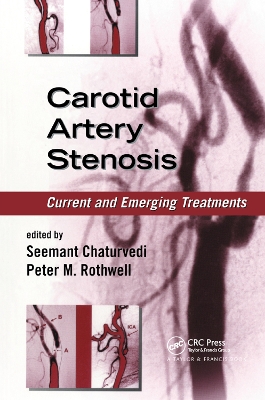 Carotid Artery Stenosis: Current and Emerging Treatments book