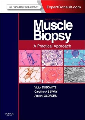 Muscle Biopsy: A Practical Approach by Victor Dubowitz