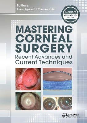 Mastering Corneal Surgery book